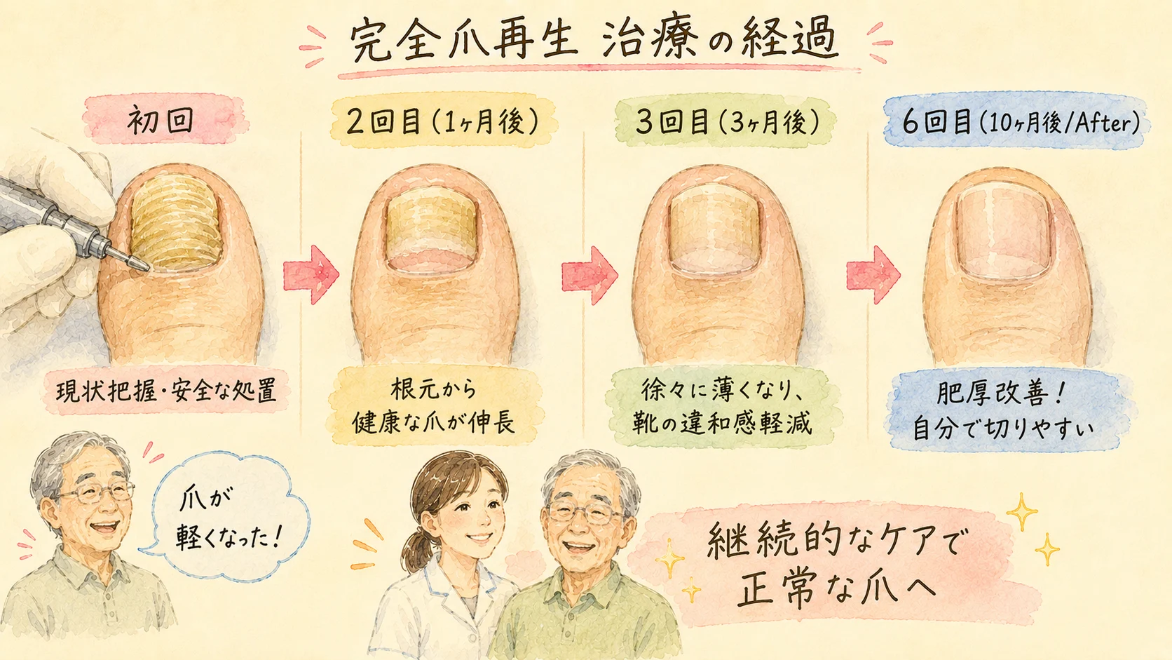 完全爪再生 治療の経過｜初回→2回目→3回目→6回目（10ヶ月後）